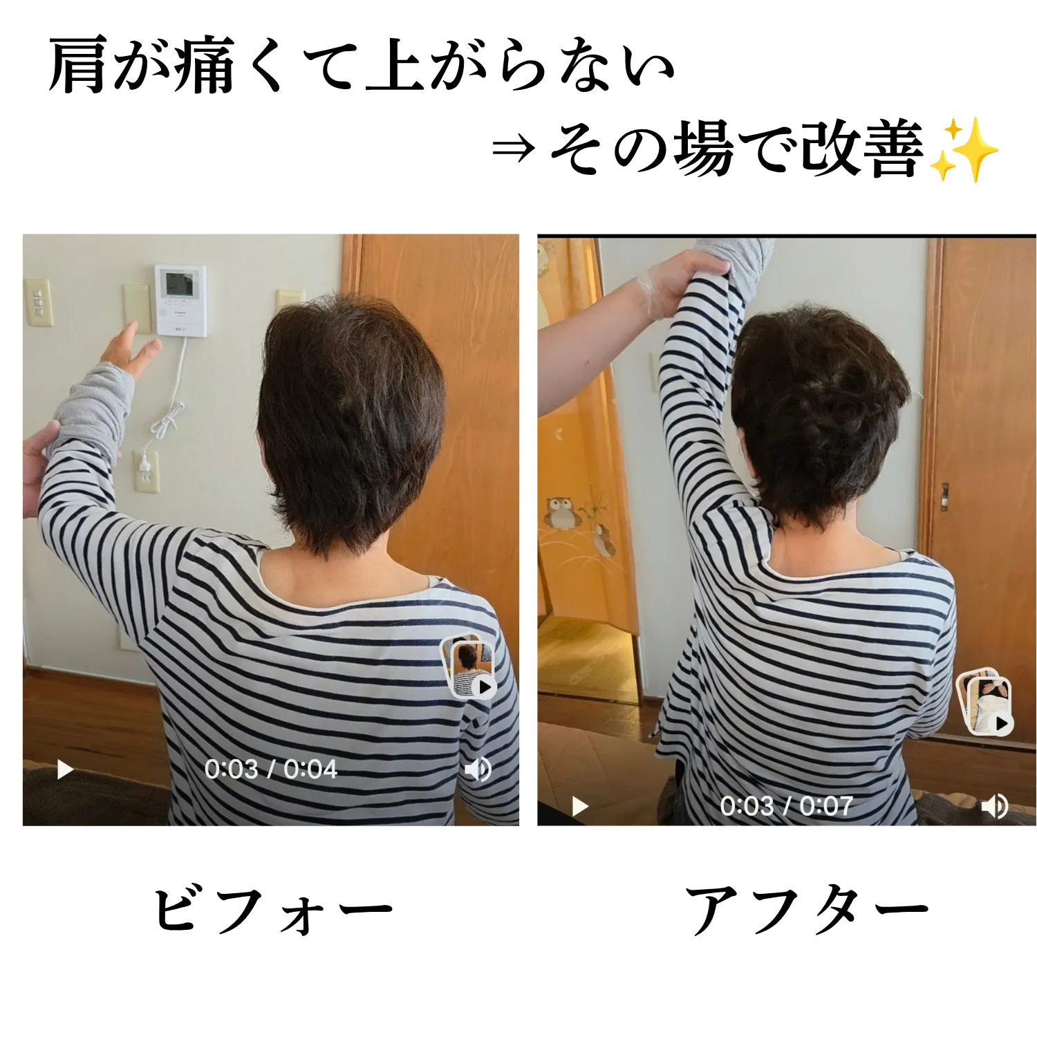 肩が痛くて上がらない