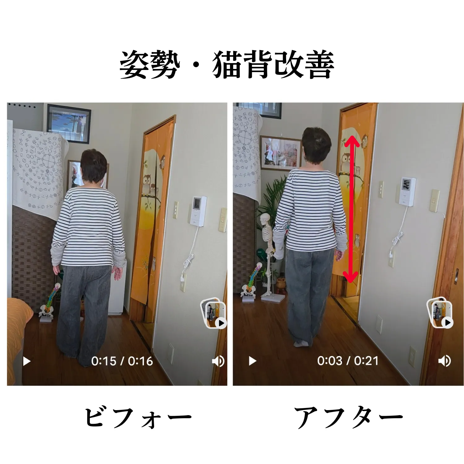 猫背改善